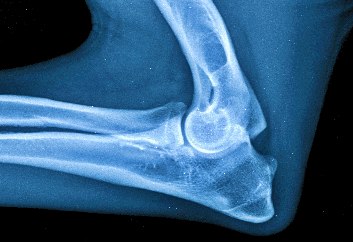 Large_Skeletal_25-45_kg_-Elbow_LAT-30._8._2017.jpg