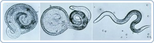 toxocariasis.jpeg